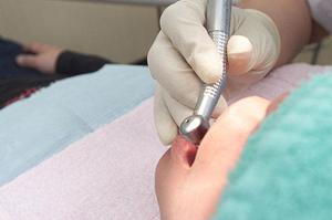 インプラントは治療前のカウンセリングが大切