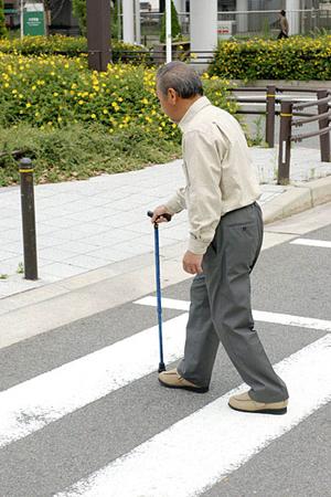 目黒区で歯列矯正をする前の注意点