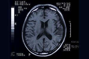 足の爪にできる水虫の対策を具体的に解説