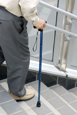 歯科インプラントの治療について